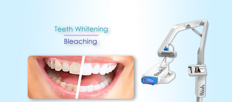 Teeth Bleaching-Whitening
